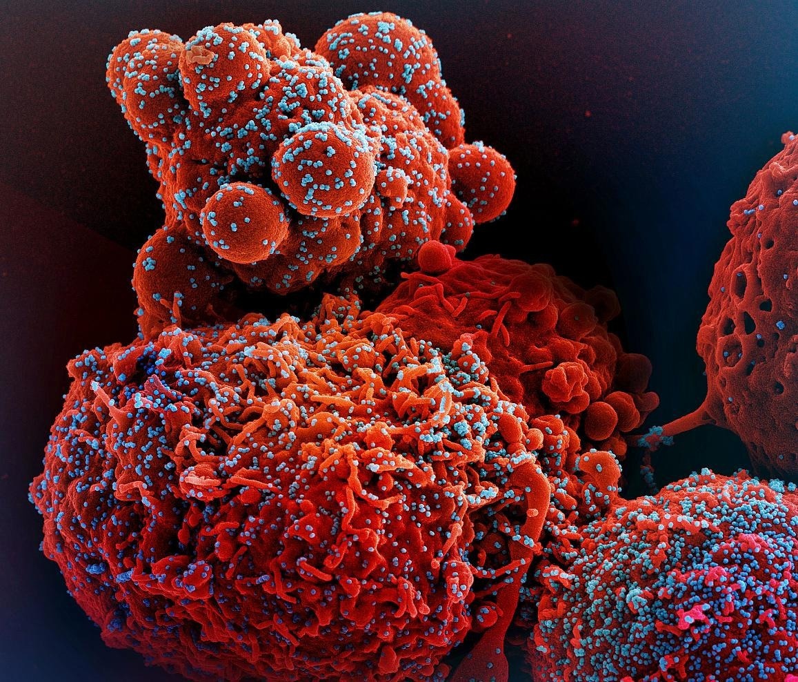 Novel tool analyzes how immune cells respond to SARS-CoV-2 vaccination