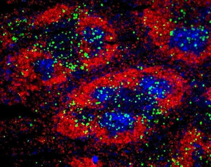 Identifying the underlying causes of rare genetic immune disorders