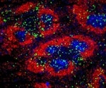 Identifying the underlying causes of rare genetic immune disorders