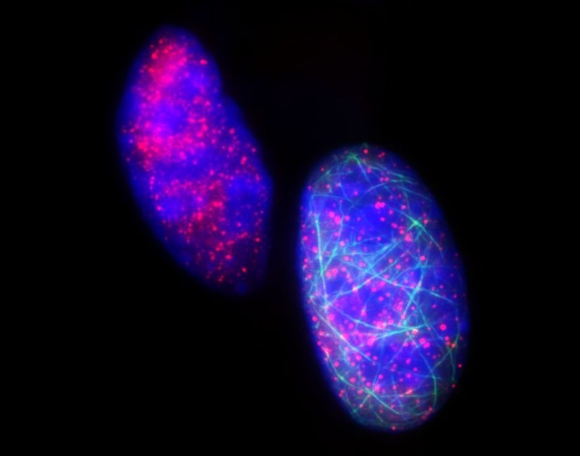RHOJ acts as a key regulator of EMT-associated resistance to chemotherapy