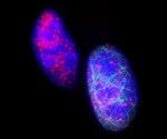 RHOJ acts as a key regulator of EMT-associated resistance to chemotherapy