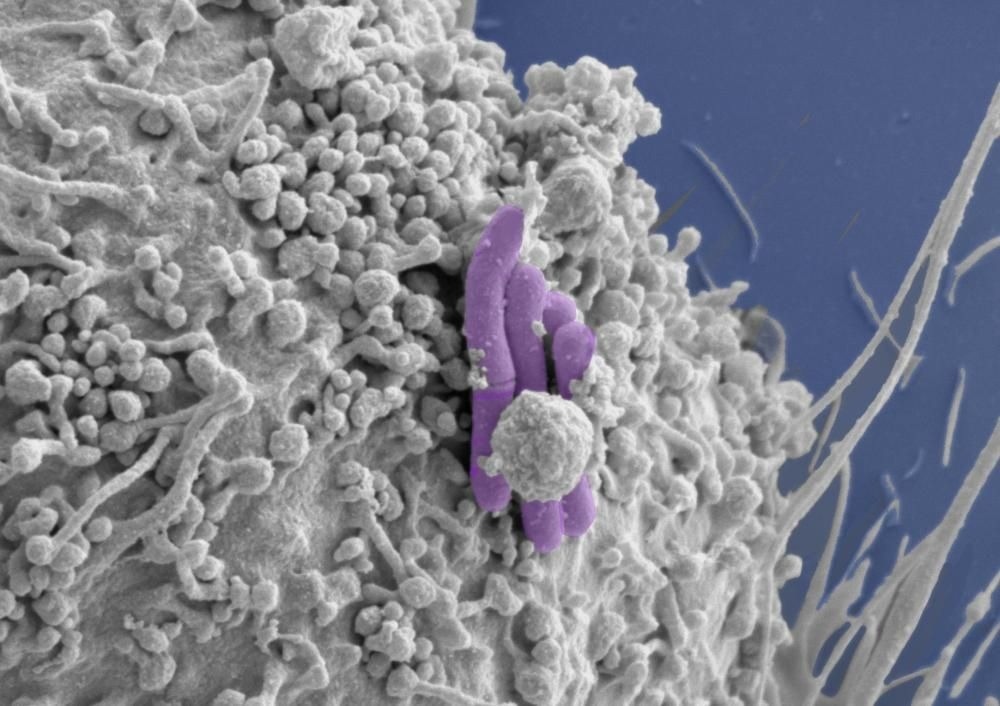 Immune system’s aptitude in reducing reliance on antibiotics for treating infections