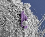 Immune system’s aptitude in reducing reliance on antibiotics for treating infections