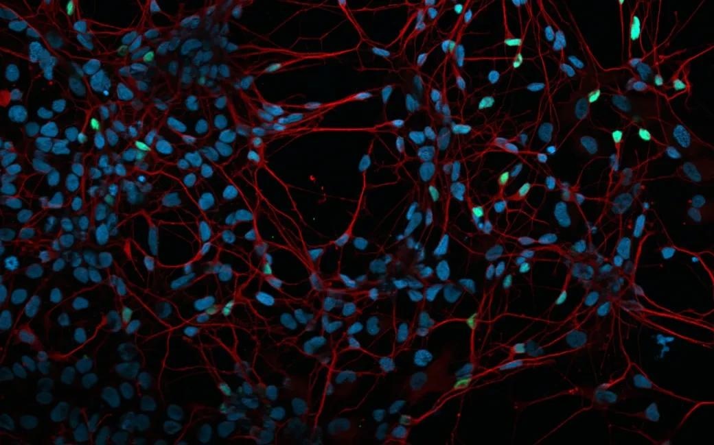 The proper implementation of stem cell-based disease models