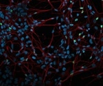 The proper implementation of stem cell-based disease models