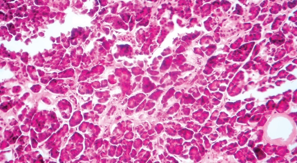 Two subtypes of cells that produce insulin discovered