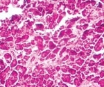 Two subtypes of cells that produce insulin discovered