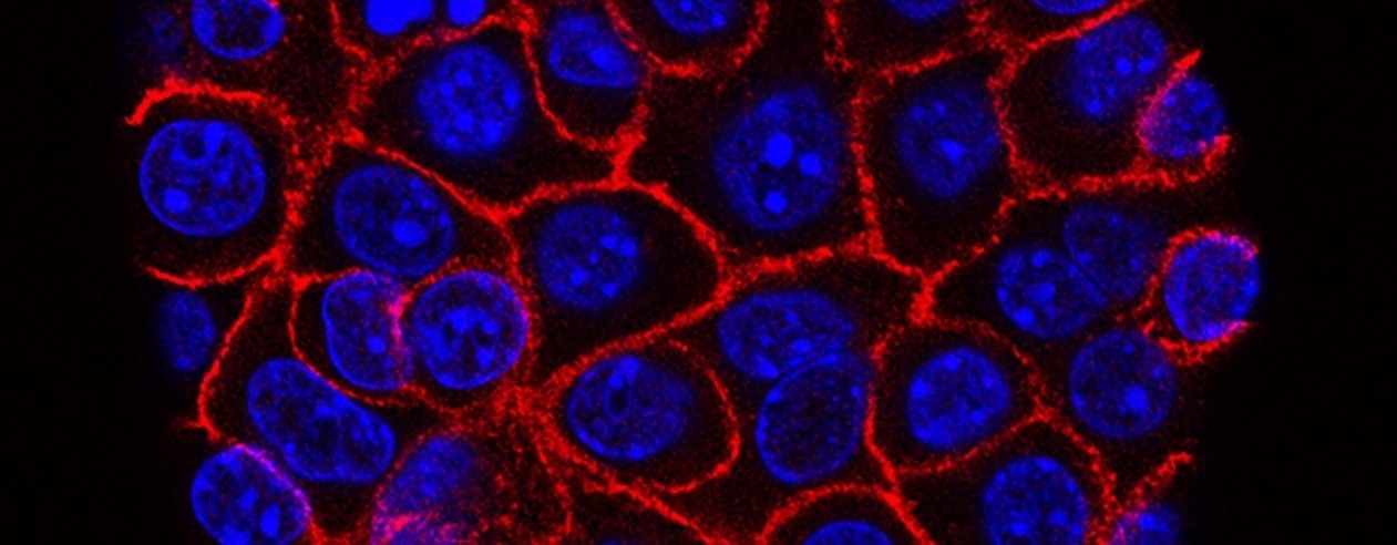 Gut Microbiome and Enhanced Tumor Immune Response in Pancreatic Cancer Survivors