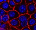 Gut Microbiome and Enhanced Tumor Immune Response in Pancreatic Cancer Survivors