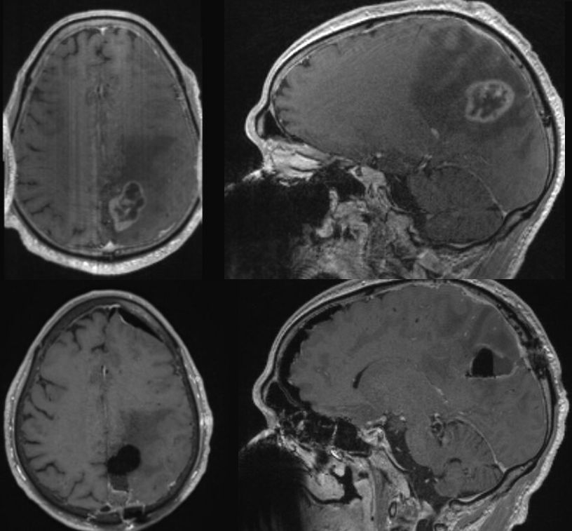 Specialized Diet Stimulates a Unique Form of Programmed Cell Death