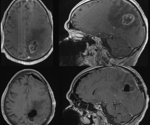 Specialized Diet Stimulates a Unique Form of Programmed Cell Death