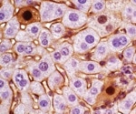 CRISPR-Cas9 Driven Gene-Editing Tool Models Liver Cancer Tumor Subtypes
