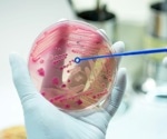Rapid Metagenomics: A Powerful Tool for the Diagnosis of Pathogenic Organisms