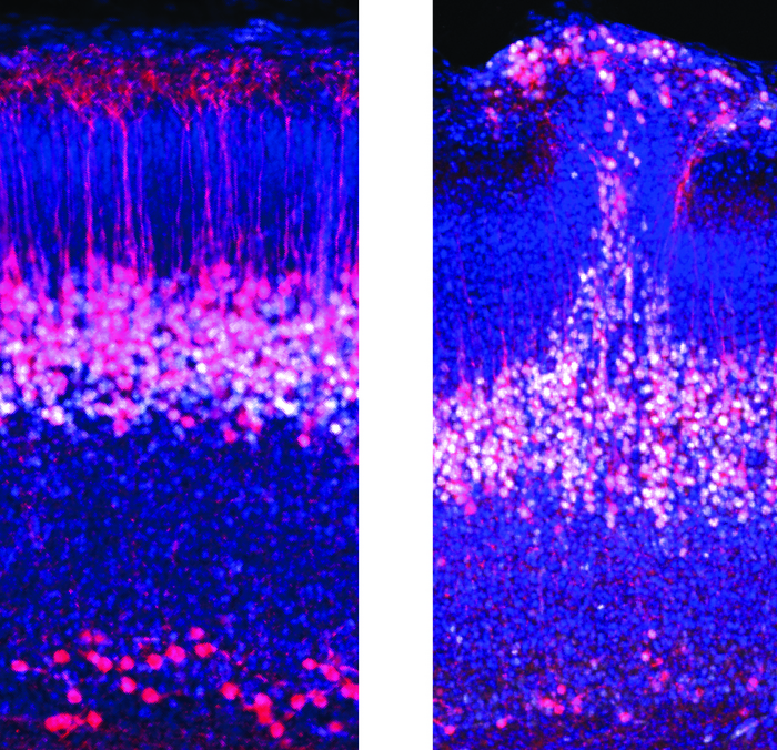 New Embryonic Brain Circuit Offers New Insights on Circuit Abnormalities in Autism New Embryonic Brain Circuit Offers New Insights on Circuit Abnormalities in Autism