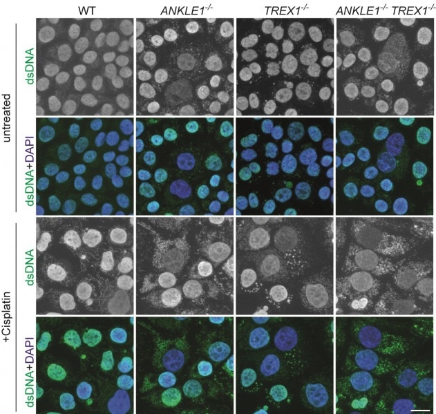 The Function of ANKLE1 in the Prevention of DNA Damage and Autoimmunity The Function of ANKLE1 in the Prevention of DNA Damage and Autoimmunity