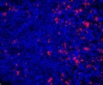 Genetic Variants of TNFAIP3 May Protect the Kidneys from Damage