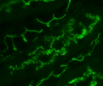 Mathematical Mechanism Behind the Rugged Structures at Cell Boundaries