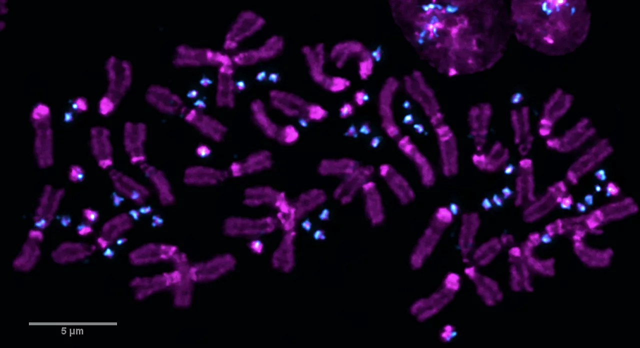Understanding How Supernumerary Chromosomes Arise Understanding How Supernumerary Chromosomes Arise