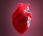 New Insights on Cases of Post-Vaccine Heart Inflammation
