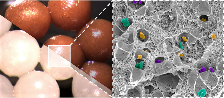 Fecal Microbiota Transplantation to Help in Clostridioides difficile Infection