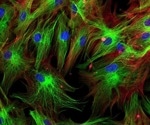 Robust AI System Identifies Protein Patterns Within Individual Cells