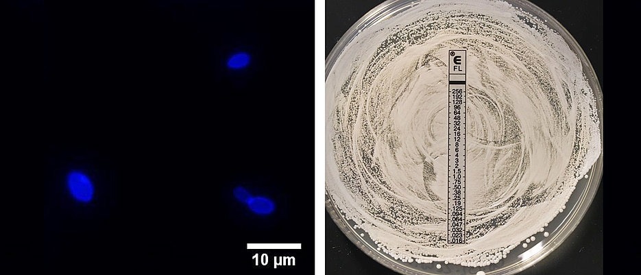 Infections with the Fungus Candida auris on the Rise in Germany