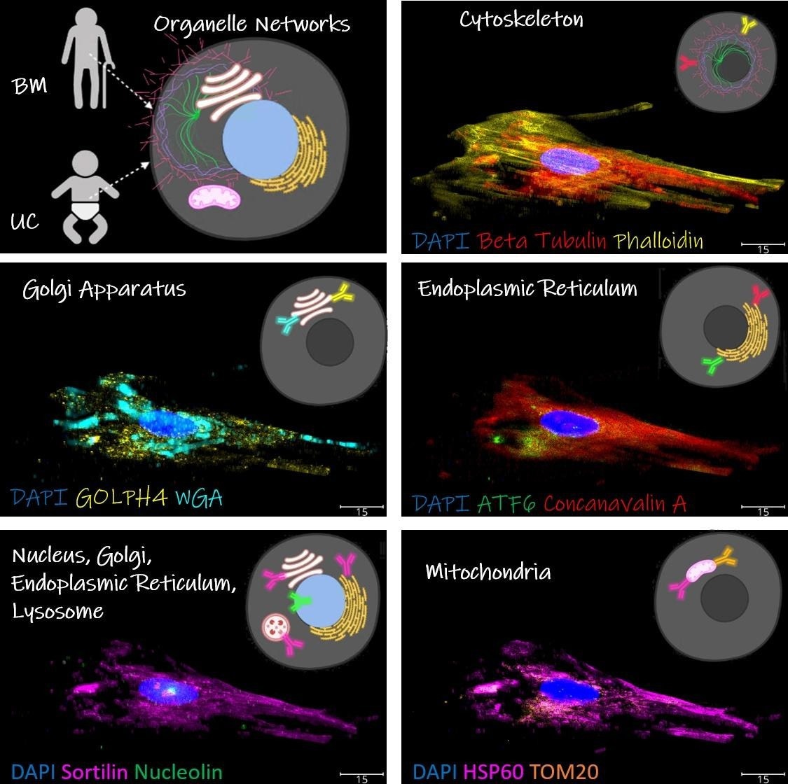 Learning More About Stem Cells Advances Personalized Regenerative Medicine