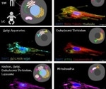 Learning More About Stem Cells Advances Personalized Regenerative Medicine