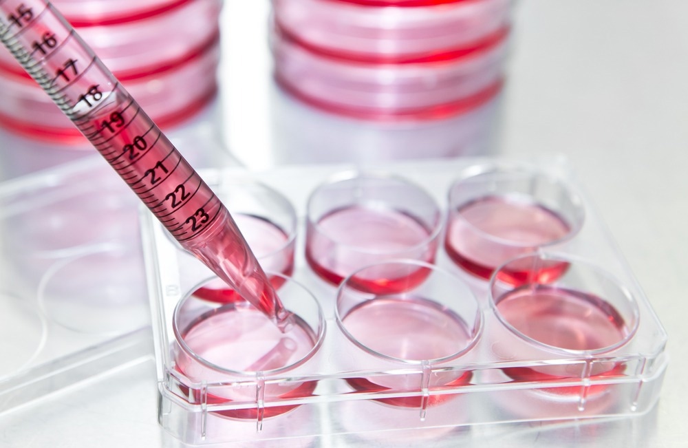 Ex Vivo Expansion of HSCs Using a Novel Culture System
