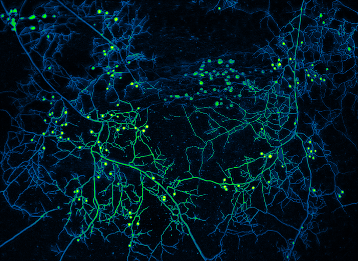Contribution Made by Mycorrhizal Associations to Global Carbon Dynamics