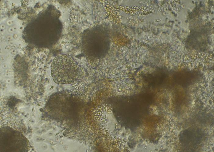 New Stem Cell Technique to Revolutionize Stem Cell Research