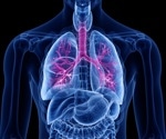 iPSC-Based Model System Helps Study Lung-Specific Mesenchyme