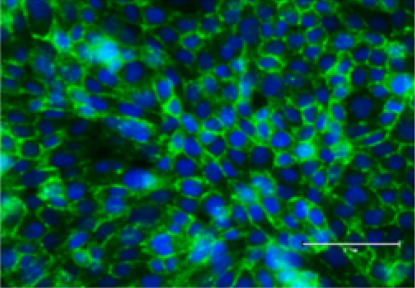 Microglial Cells Serve as a Stable Viral Reservoir for Latent HIV