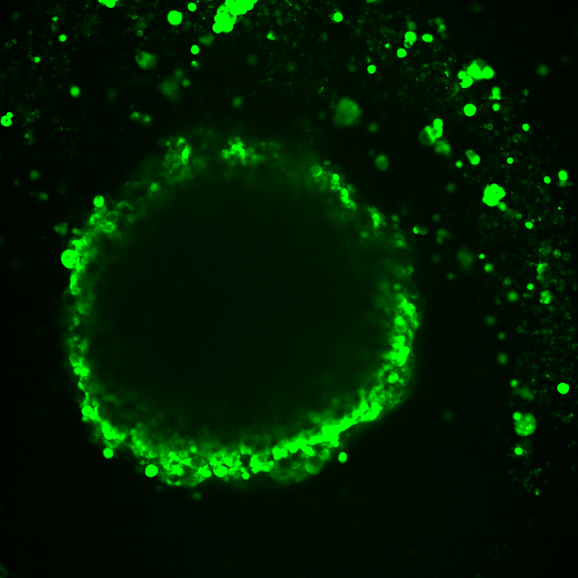 New Research Provides Insights into Cancer Progression and Treatment Response