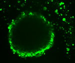 Location-Dependent Gene Expression in Ovarian Cancer: Insights from 3-D Models