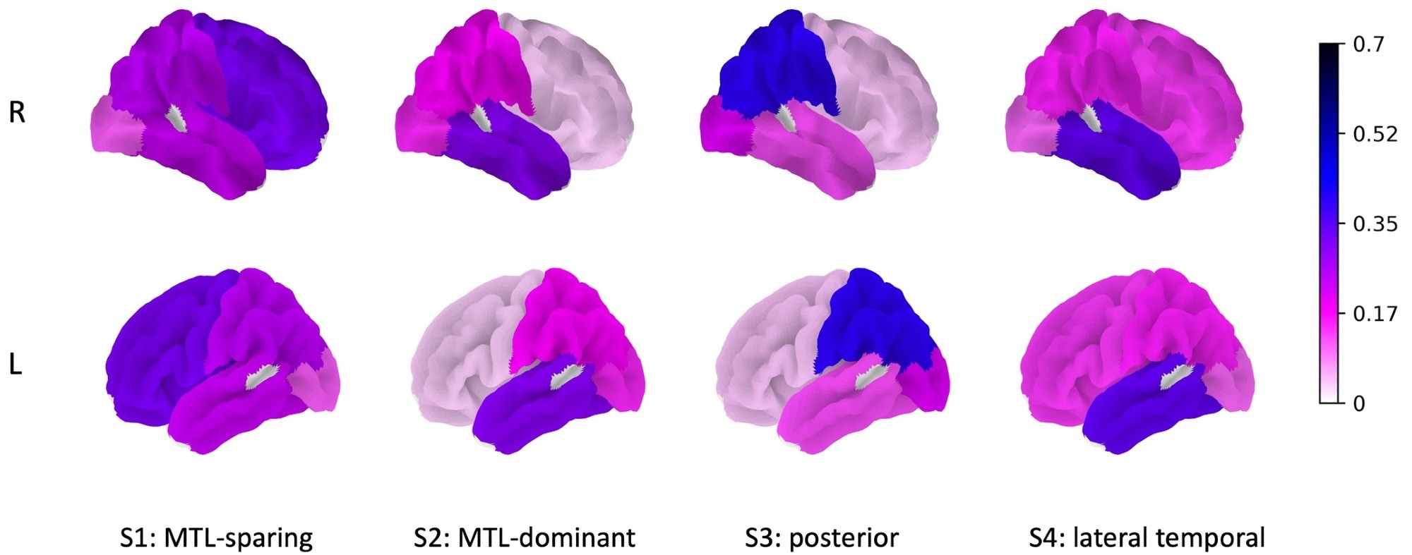 New Computational Methods for Improving Alzheimer’s Disease Characterization
