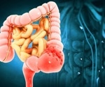Discovering a Major Factor Causing Aggressive Cancer