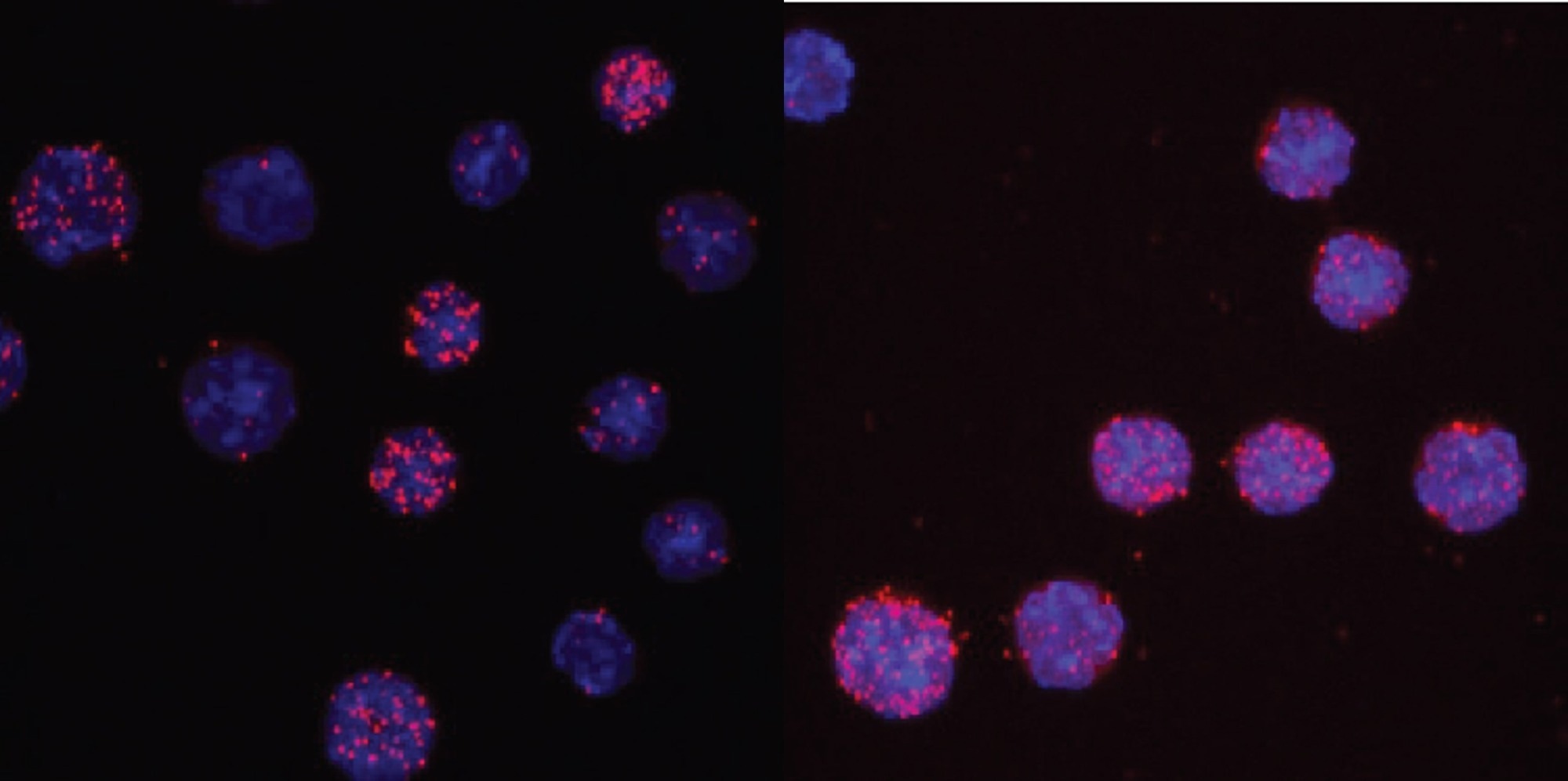 Cell Fate Conversion Plays Crucial Role in Cancer Research
