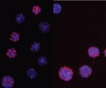 Cell Fate Conversion Plays Crucial Role in Cancer Research