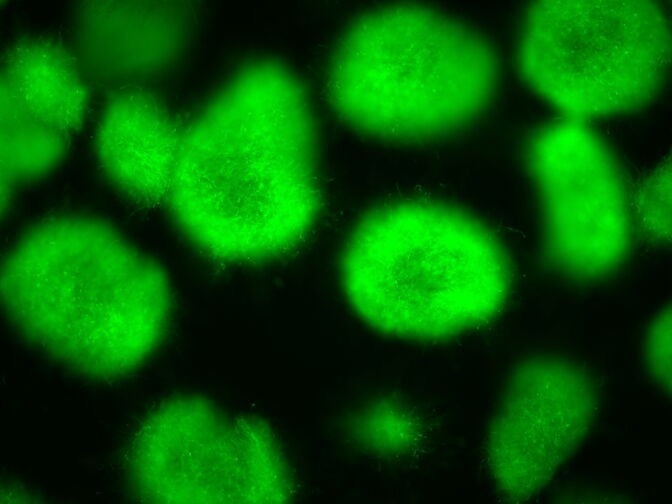 The Influence of Streptomyces on Soil Microorganisms