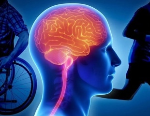 Identifying the Genetic Variant That Increases Disease Severity in MS