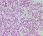 New Protein Found to be Key to Proper Functioning of Acinar Cells