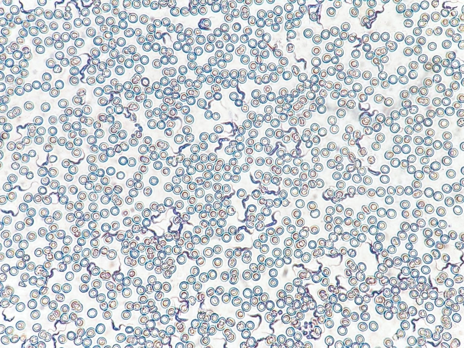 T Cells Play a Dual Role in Wasting During Infection