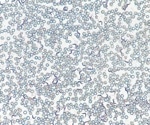 T Cells Play a Dual Role in Wasting During Infection