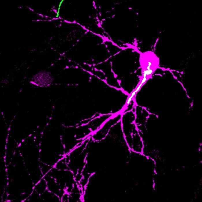 The Role of the Golgi Apparatus in the Development of Postnatal Neurons