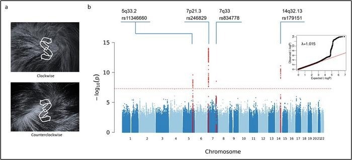 Hair Whorl Direction Influenced by Multiple Genes