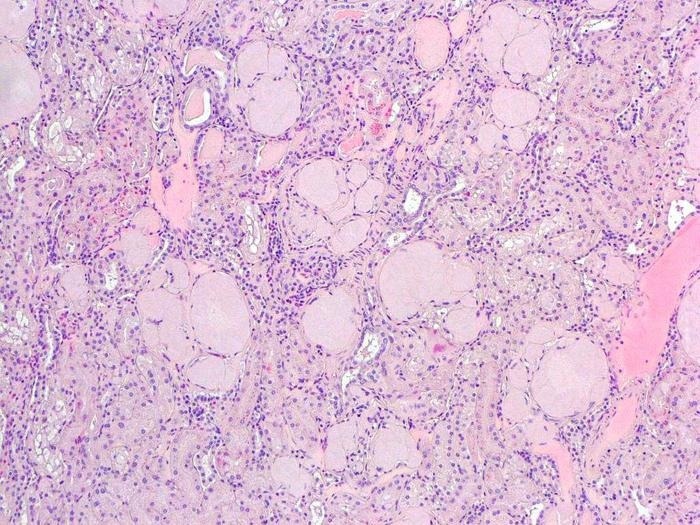 The Prevalence of Fibrinogen Aα-Chain Amyloidosis in Japanese Squirrels