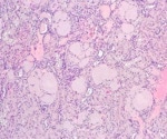 The Prevalence of Fibrinogen Aα-Chain Amyloidosis in Japanese Squirrels