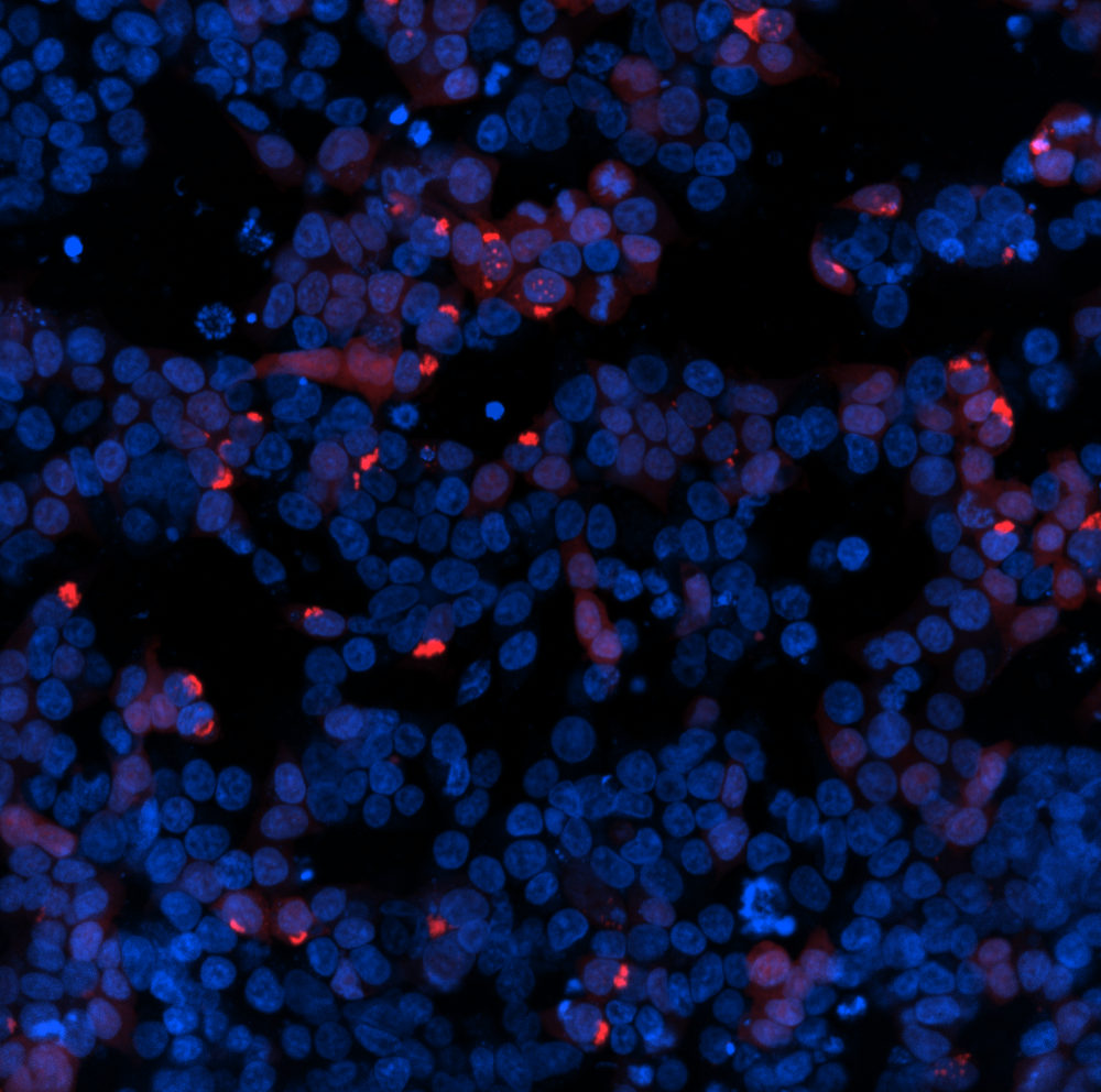 Viral Proteins Promote the Spread of Protein Aggregates in the Brain