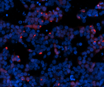 Viral Proteins Promote the Spread of Protein Aggregates in the Brain